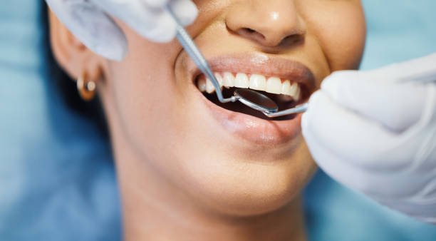 Dentist for Dental Trauma in CA